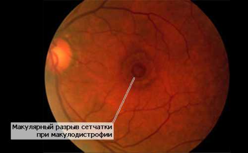 Обязательно проконсультируйтесь с вашим лечащим врачом