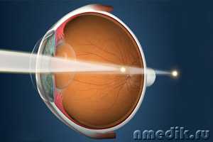 Головокружение