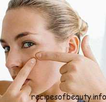Лечение угрей на лице  в домашних условиях: что