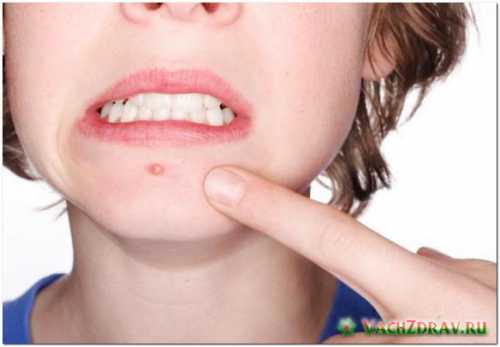 Разведите сухие дрожжи водой до густой консистенции