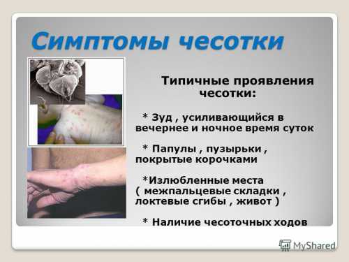 Симптомы, лечение  и профилактика чесотки