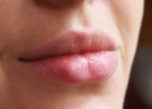 Ваша задача помочь организму справиться сней, для чего можно использовать указанные выше мази при разрыве язвочек выделяется жидкость, насыщенная вирусами