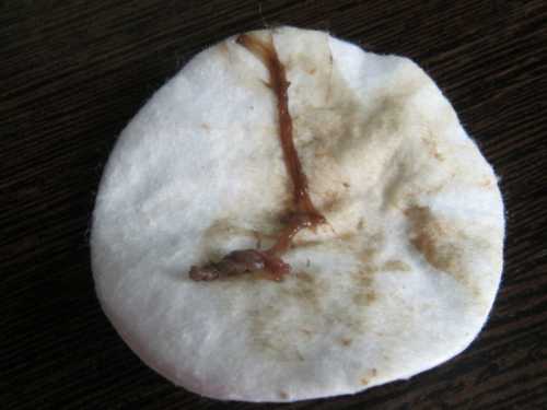 Выделения при беременности