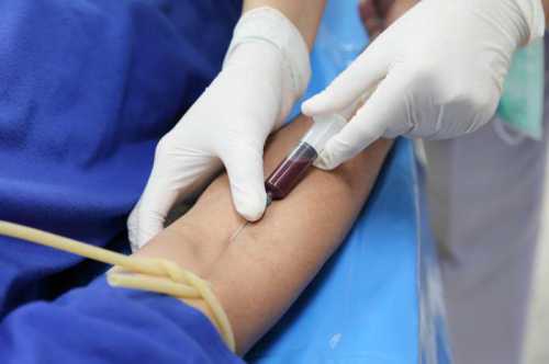 Анализ крови на антитела при беременности