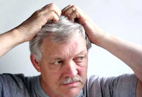 Зуд кожи головы основные причины