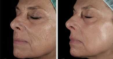 Продлить молодость можно за 3 минуты в день Поможет этот секретный метод