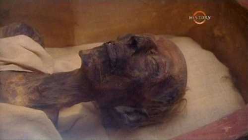 Пластическая хирургия древности