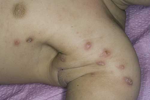 Однако в последнее время появилось новое средство, лечебные качества которого во многом уникальны