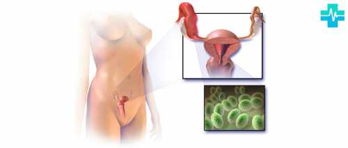 Женщина жалуется на зуд и жжение во влагалище